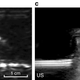 The image on the left is the result of using lasers to image a metal object embedded in a gelatin mold, while the image on the right is the same subject imaged using traditional ultrasound techniques.